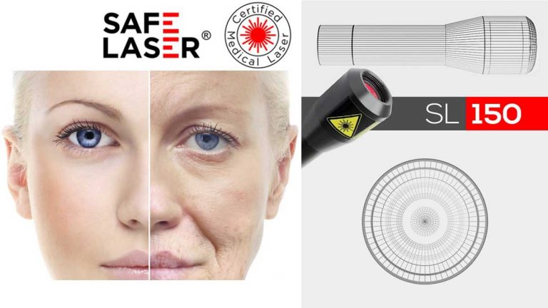 Safe Laser kozmetikai kezelő