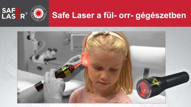 Safe Laser a fül- orr- gégészetben